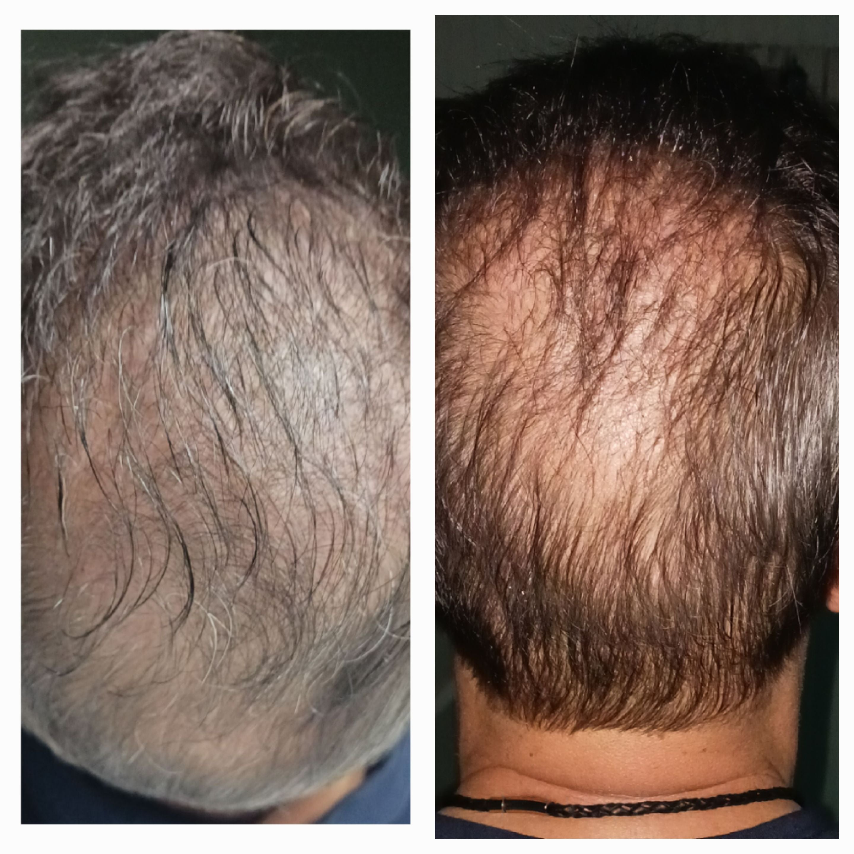 Procell Hair Care Serum with Stem Cell Cytokines and Growth Factors